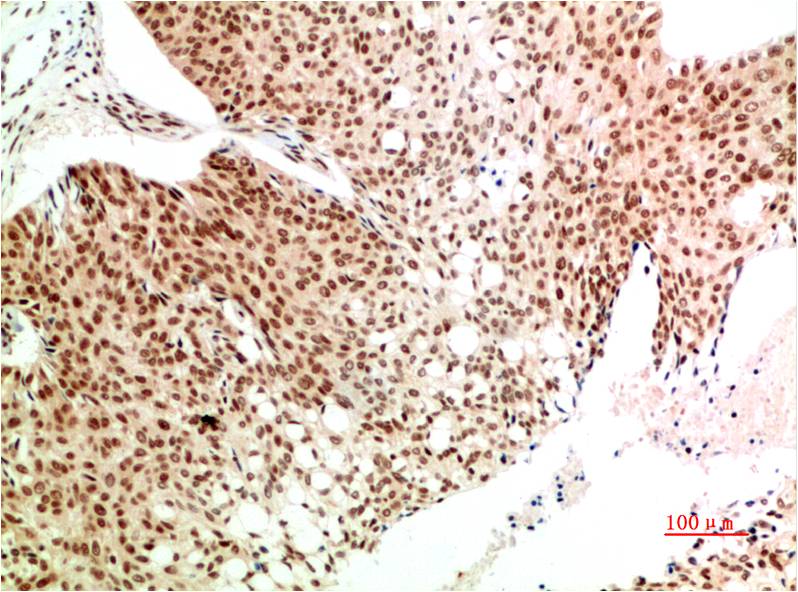 ATM Monoclonal Antibody (1A9)