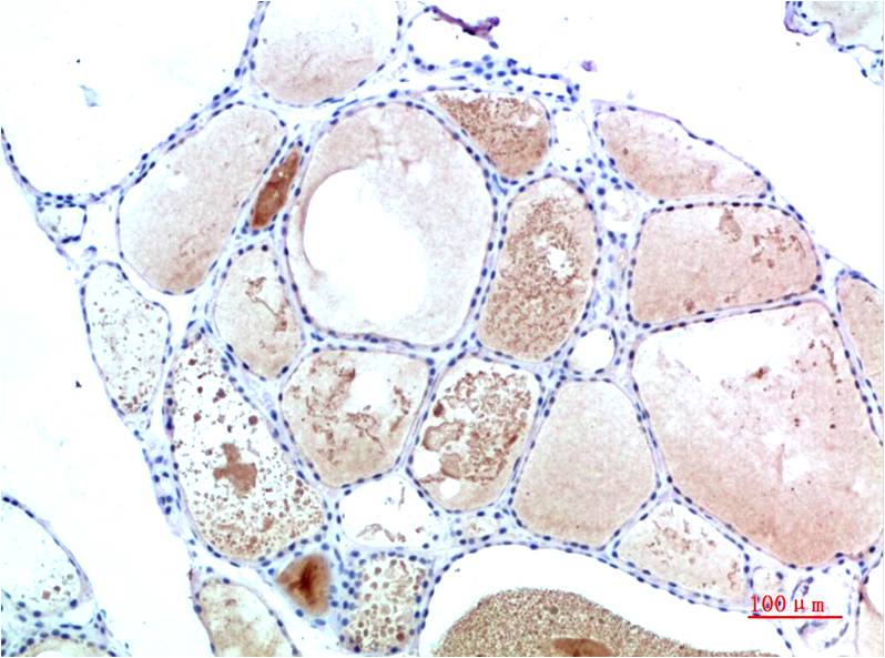 TTR Monoclonal Antibody (2B12)