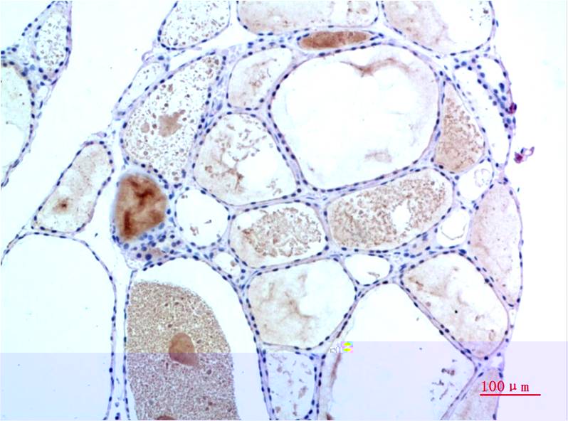 TTR Monoclonal Antibody (3F2)