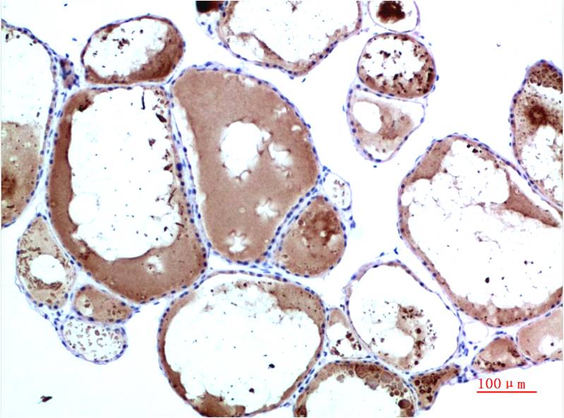 TTR Monoclonal Antibody (4E4)