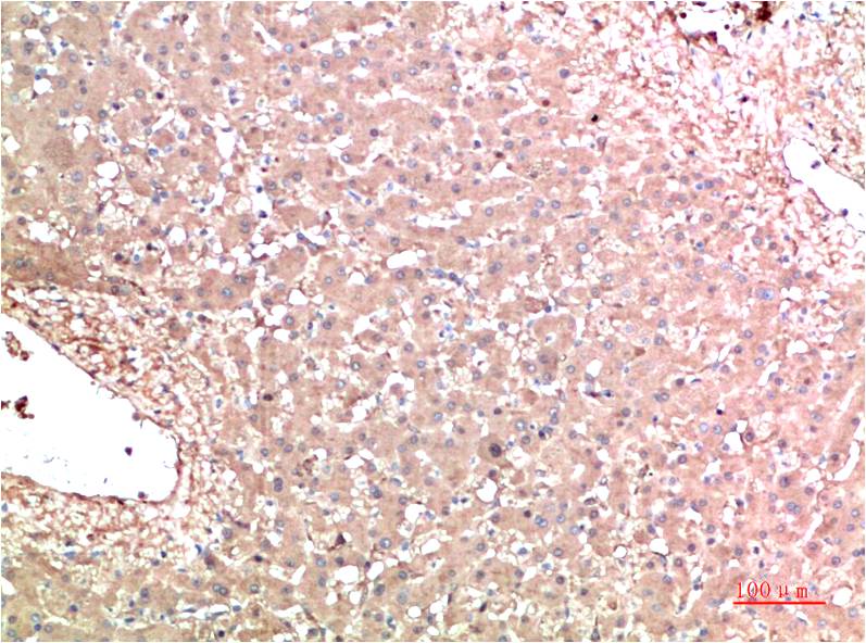 TTR Monoclonal Antibody (5D2)