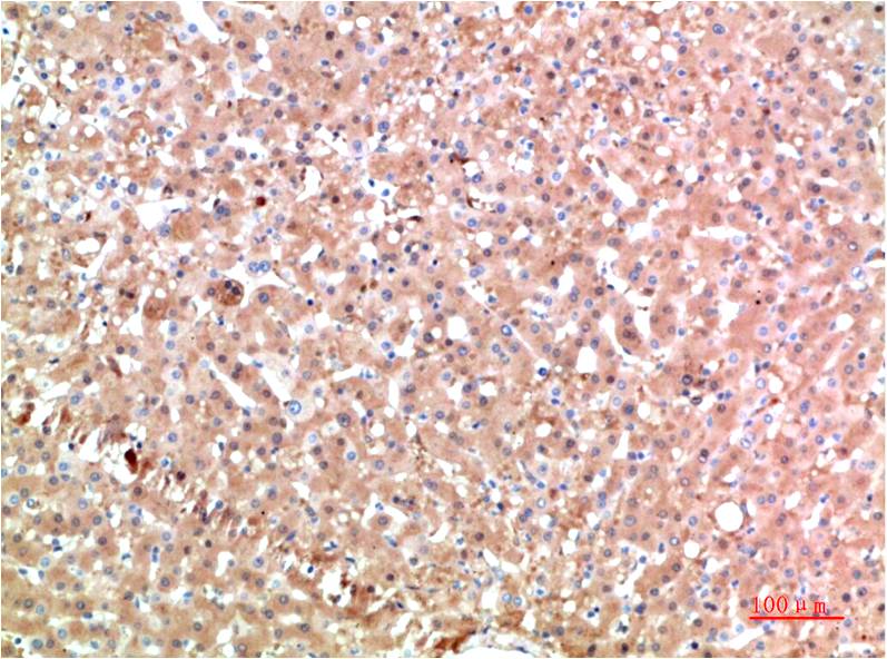 TTR Monoclonal Antibody (6E5)