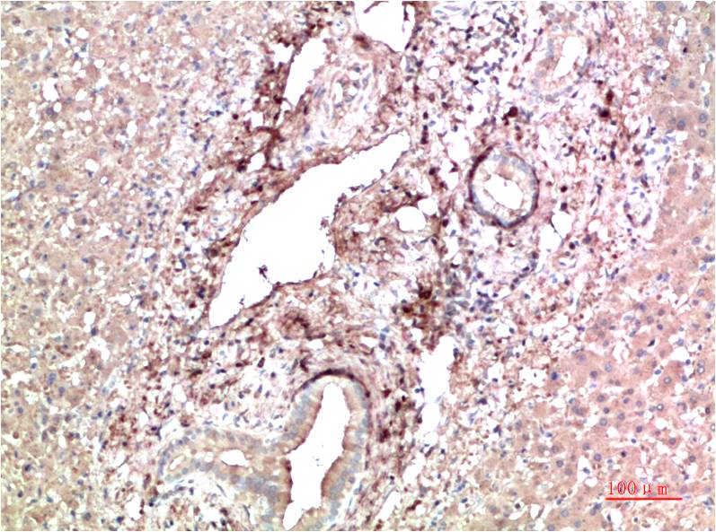 TTR Monoclonal Antibody (9D9)