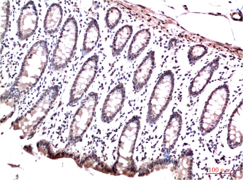 HP-1 Gamma Monoclonal Antibody (2F5)