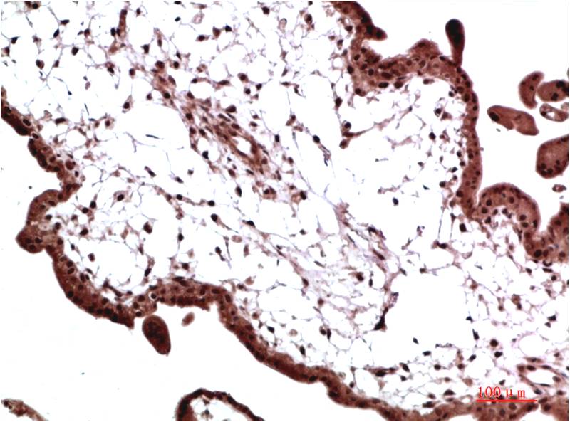 HP-1 Gamma Monoclonal Antibody (4F4)