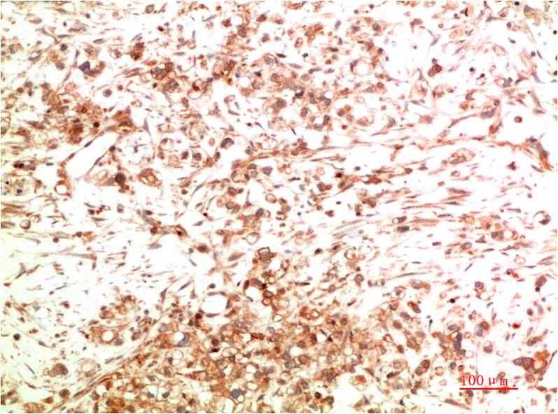 ATG5 Monoclonal Antibody (8B4)