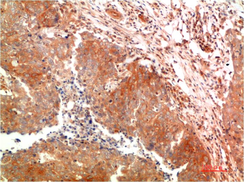 ATG5 Monoclonal Antibody (8B4)