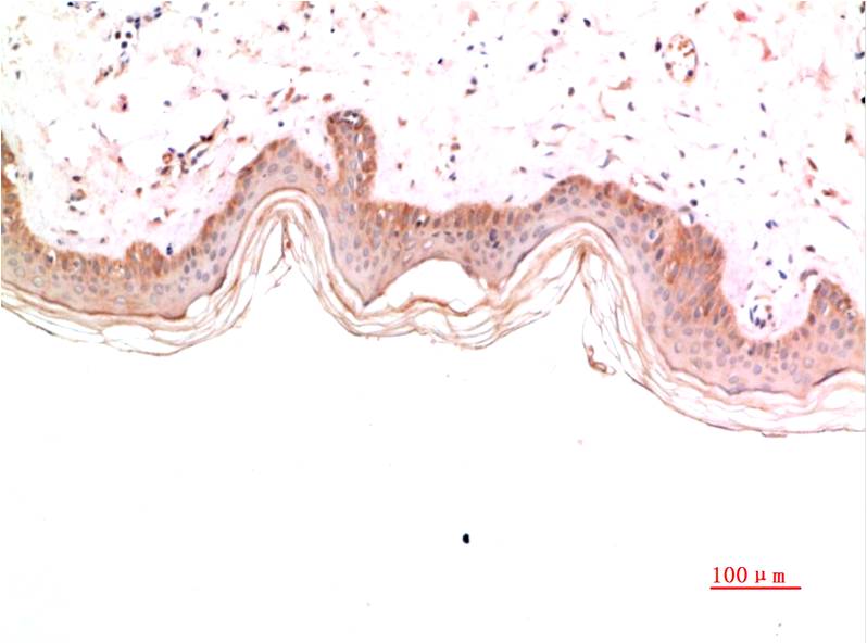 Collagen IV Monoclonal Antibody (8E5)