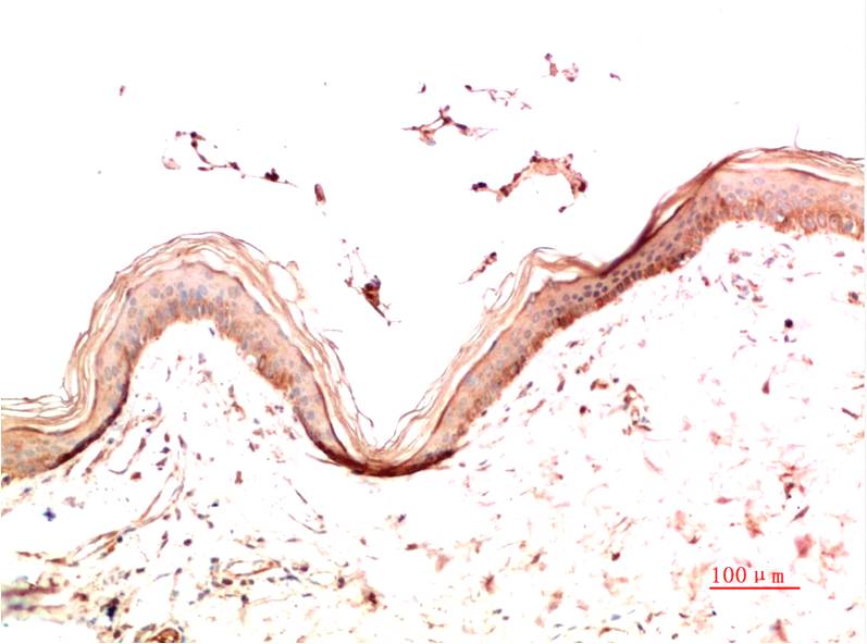 Collagen IV Monoclonal Antibody (4D1)