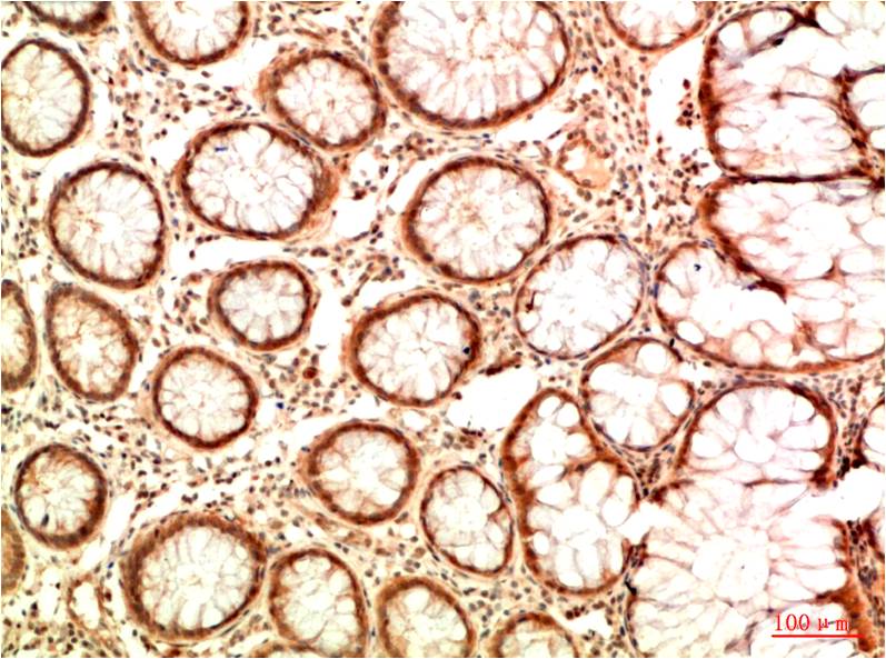 Acetyl P53 (K382) Monoclonal Antibody (5H10)