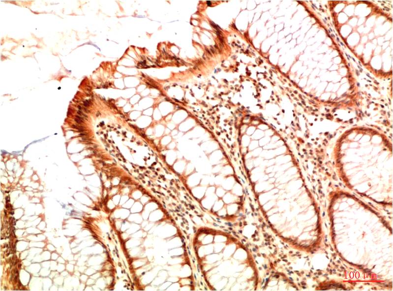 Acetyl P53 (K382) Monoclonal Antibody (5H10)