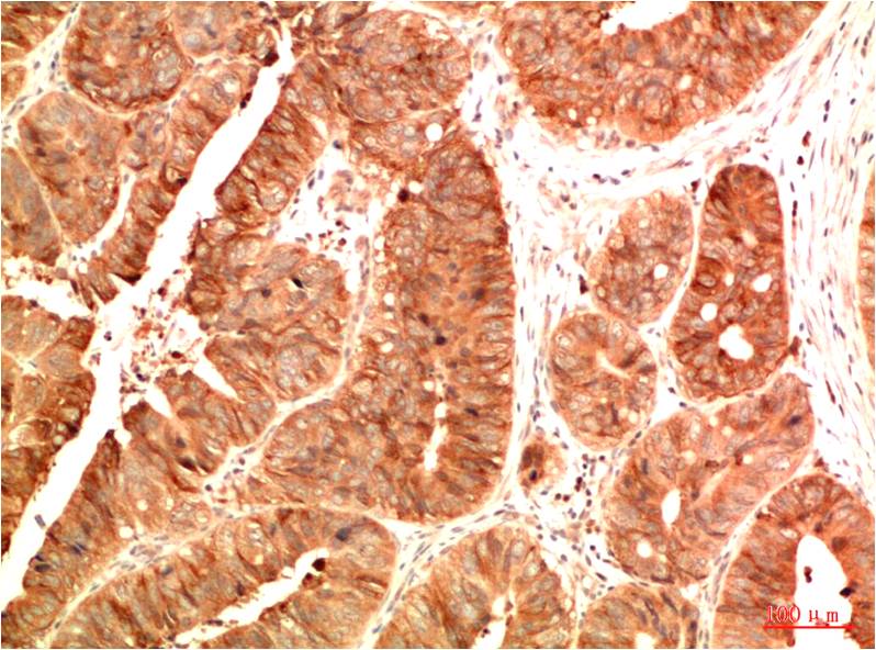 Acetyl P53 (K382) Monoclonal Antibody (15F4)