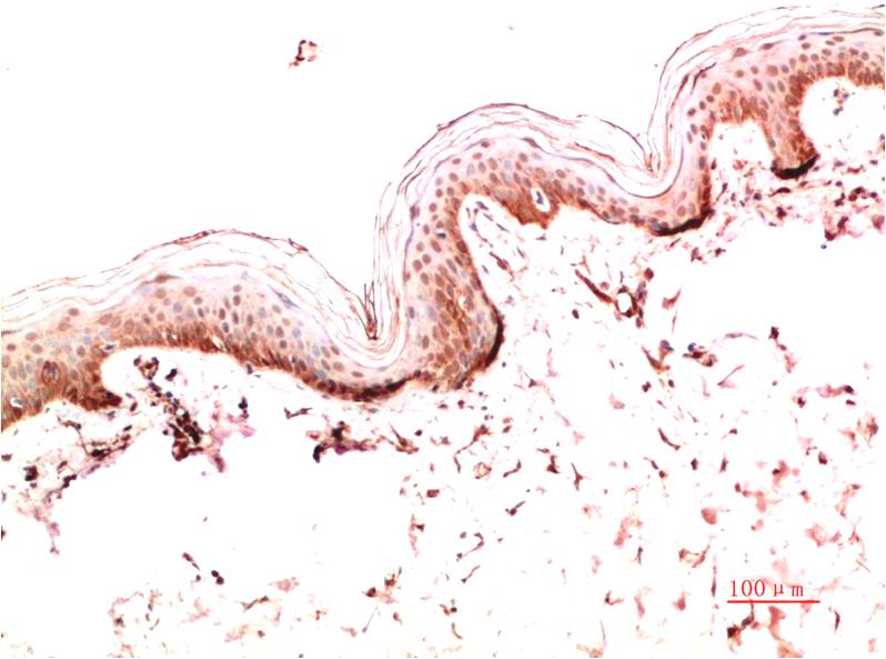 Collagen I Monoclonal Antibody (4H10)