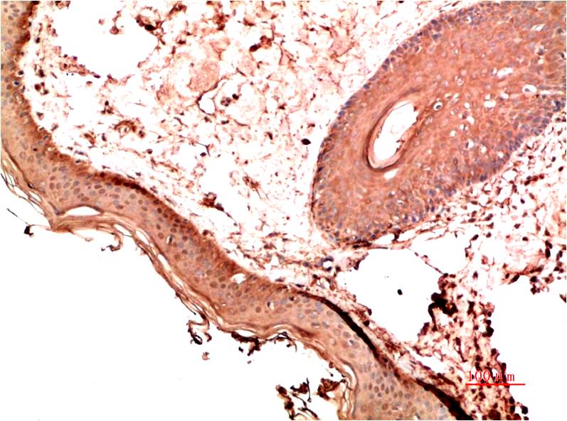 Collagen I Monoclonal Antibody (1B2)
