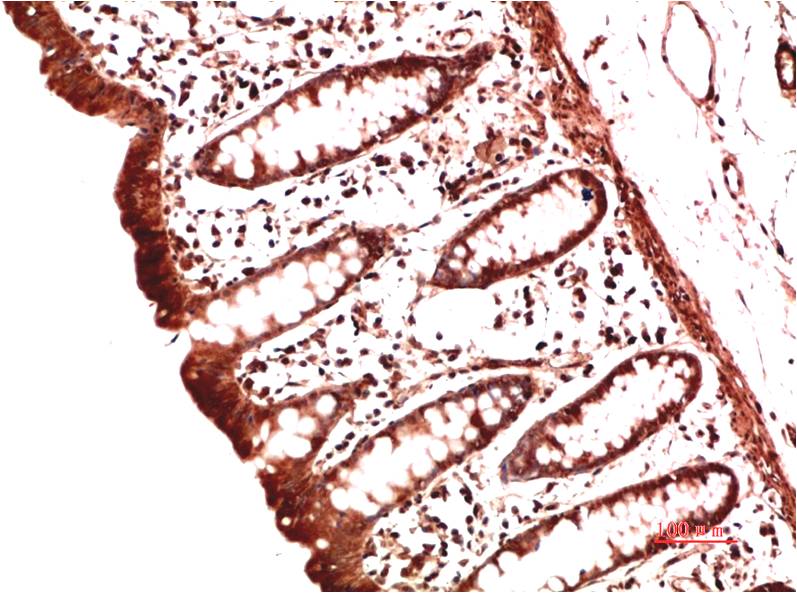 Collagen II Monoclonal Antibody (9F11)