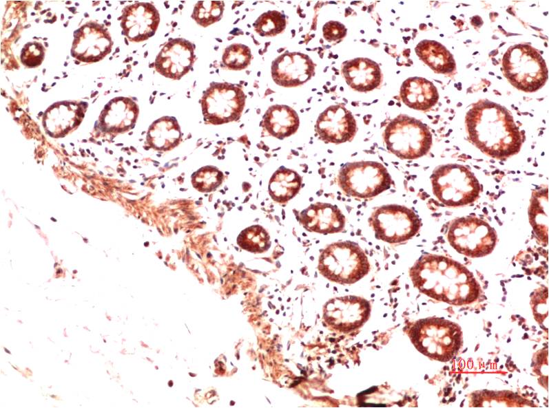 Collagen II Monoclonal Antibody (9C5)