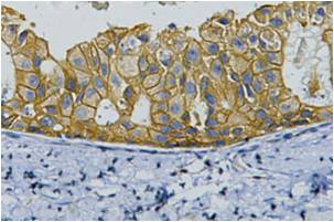 ErbB2-HER-2 Monoclonal Antibody (11H9)