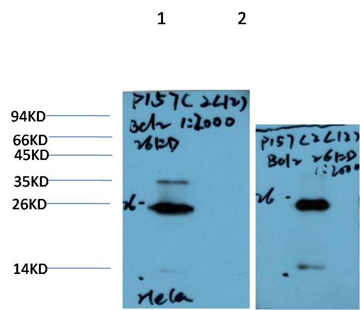 Bcl-2 Monoclonal Antibody (2C12)