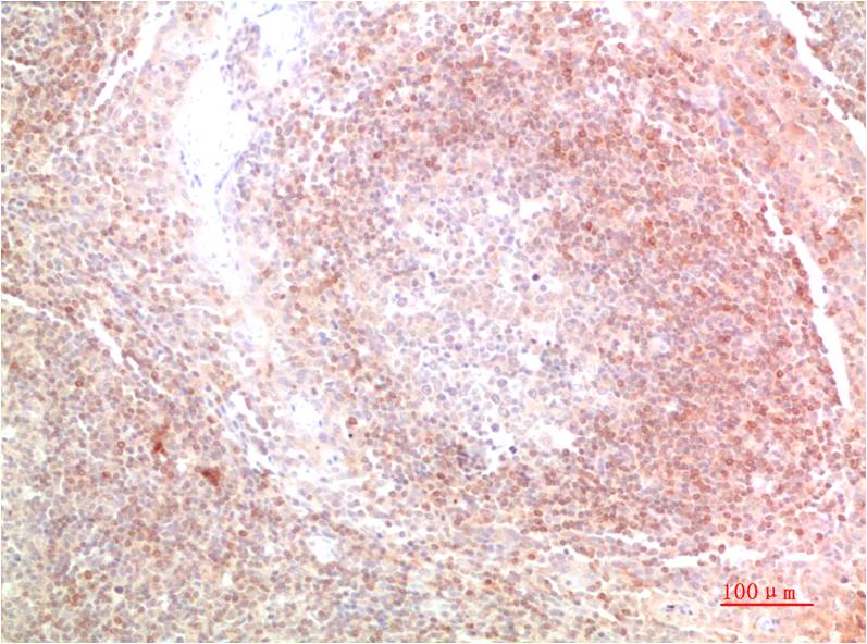 Bcl-2 Monoclonal Antibody (2F1)