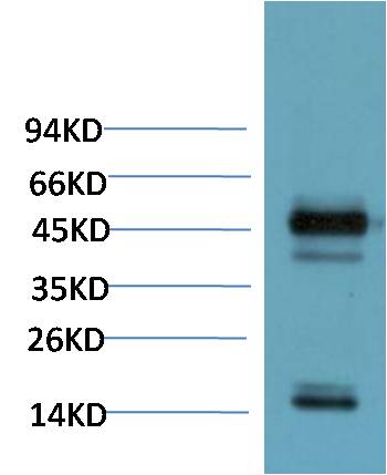 PAX-8 Monoclonal Antibody (2B11)