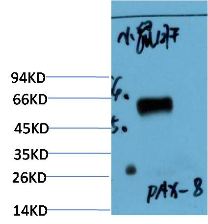 PAX-8 Monoclonal Antibody (5B1)