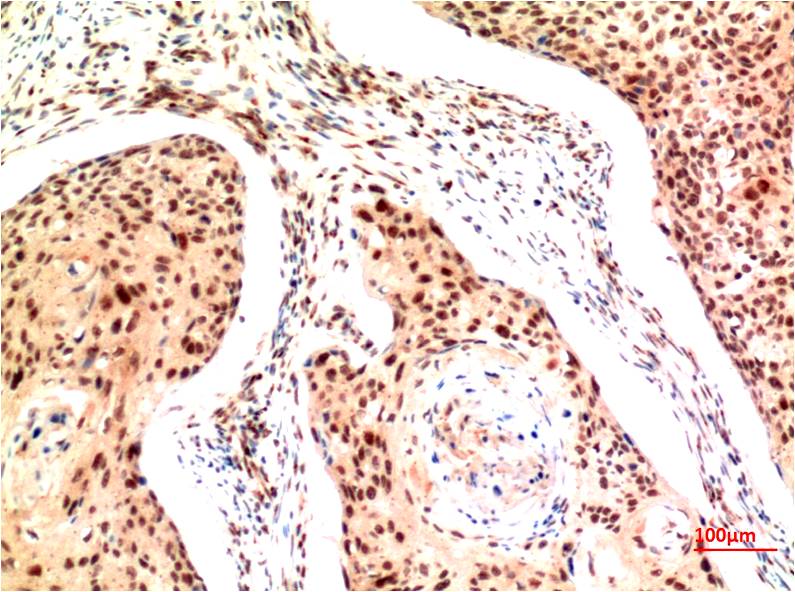 TFE3 Monoclonal Antibody (8B4)