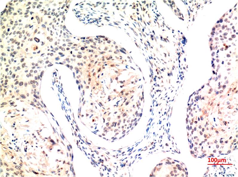 TFE3 Monoclonal Antibody (6B8)
