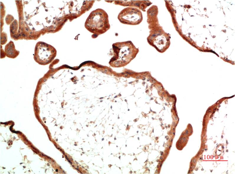 TGFBetaReceptor III Monoclonal Antibody (10E10)