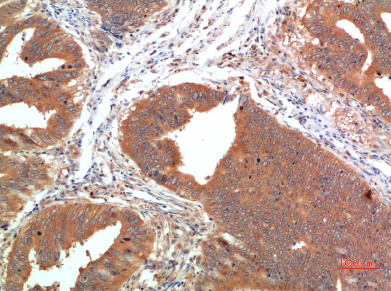 TGFBetaReceptor III Monoclonal Antibody (10E10)