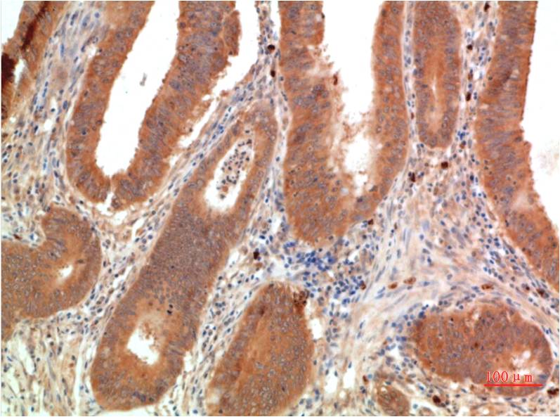 TGFBetaReceptor III Monoclonal Antibody (2B7)