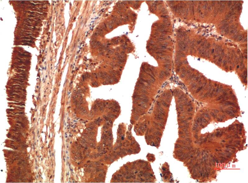 TGFBetaReceptor III Monoclonal Antibody (5D11)