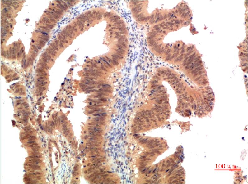 TGFBetaReceptor III Monoclonal Antibody (7G11)