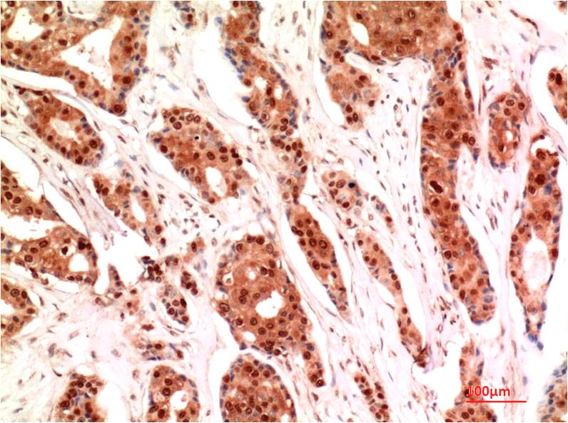 Ubiquitin Monoclonal Antibody (1A5)