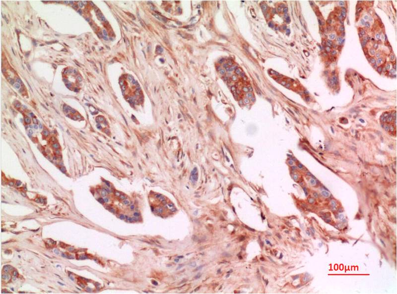 P53 Monoclonal Antibody (4A12)
