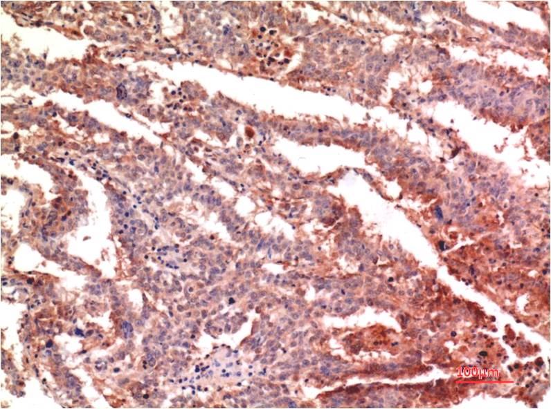 P53 (Di Methyl Lys370)Monoclonal Antibody (1G8)