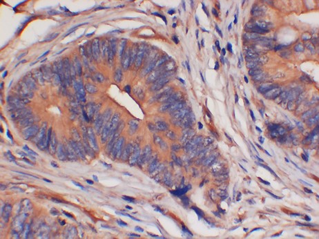 14-3-3 eta Monoclonal Antibody (5F2)