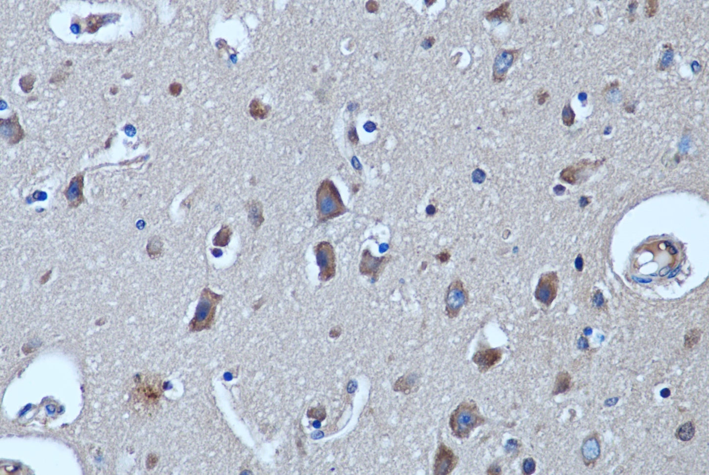 CDK5 Monoclonal Antibody (3D1)