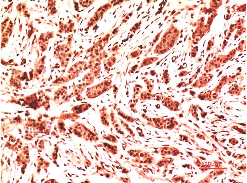 Ubiquitin Monoclonal Antibody (2G3)