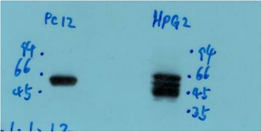 Peripherin Monoclonal Antibody (3H1)