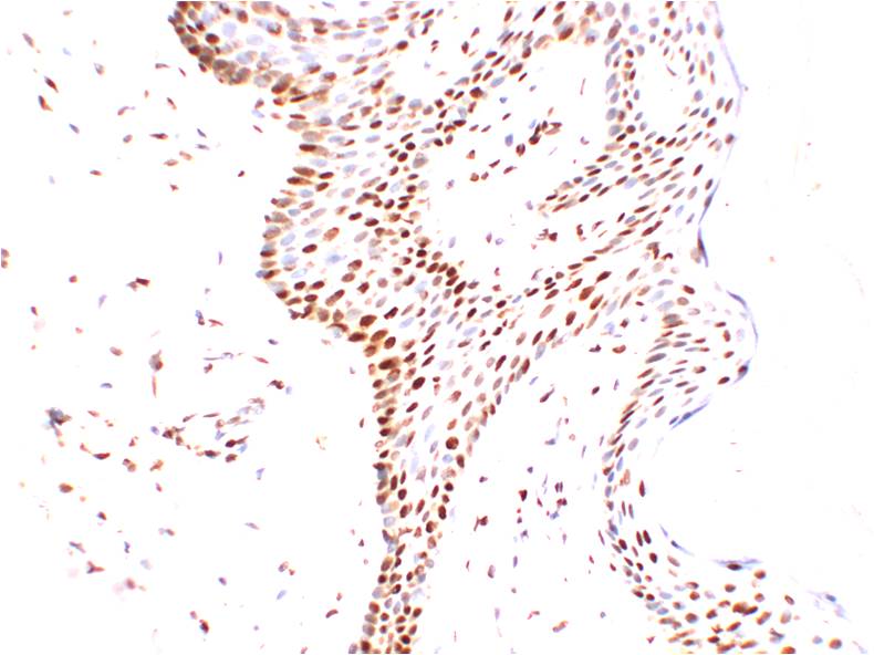TRP2 DCT Monoclonal Antibody (2A10)