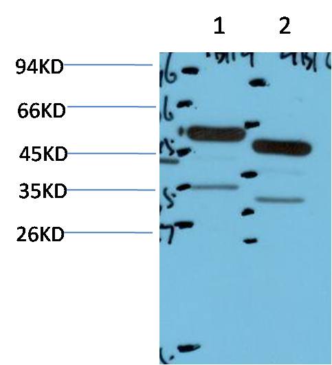 Tyrosine Hydrolase Monoclonal Antibody (4B1)