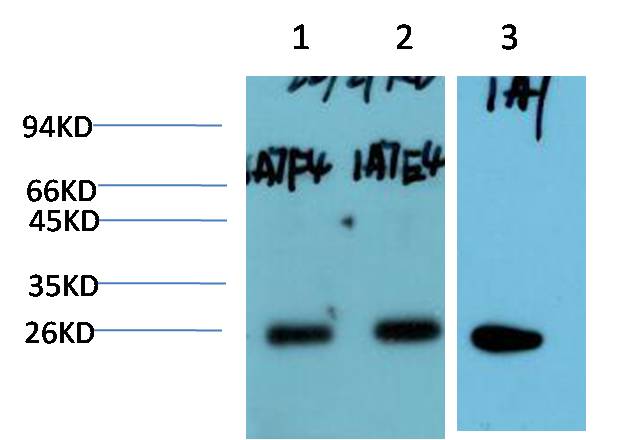 P27 Kip1 Monoclonal Antibody (1A7)