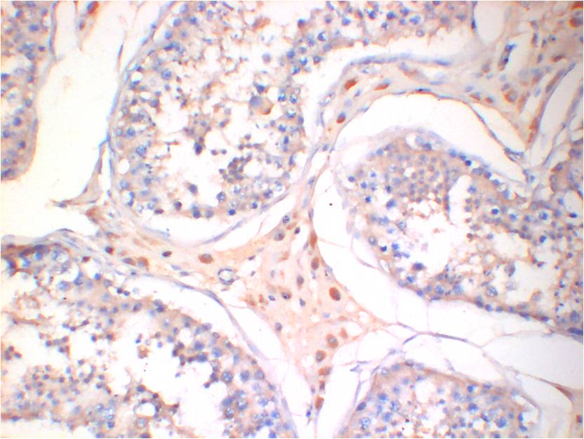 AMPK Gamma1 Monoclonal Antibody (5A1)