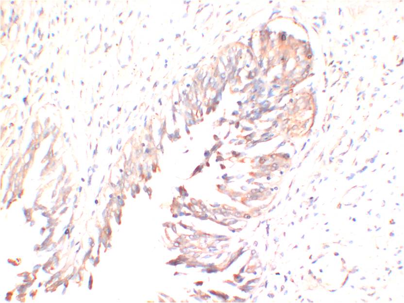 AMPK Gamma1 Monoclonal Antibody (5H5)