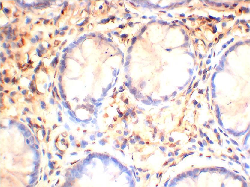 AMPKBeta1 Monoclonal Antibody (5D8)