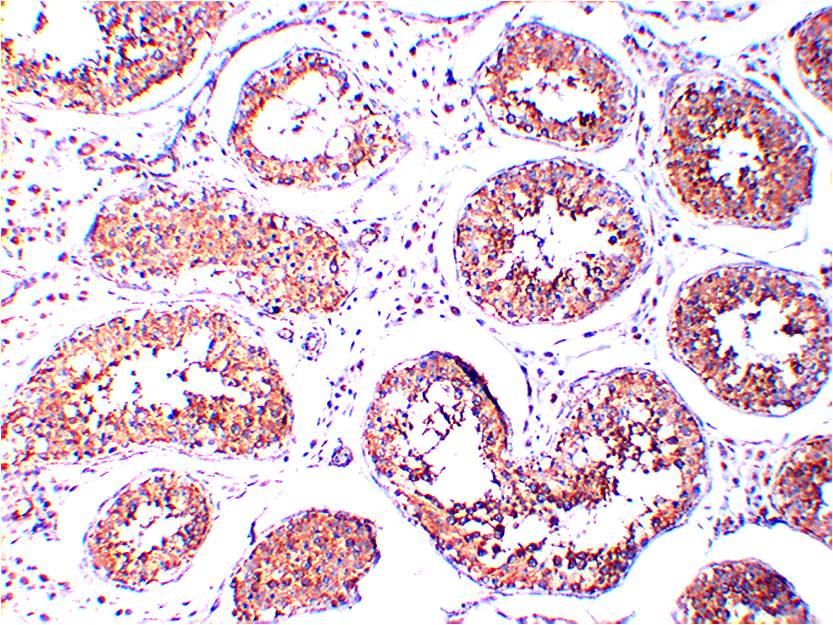 AMPK Gamma1 Monoclonal Antibody (3G12)