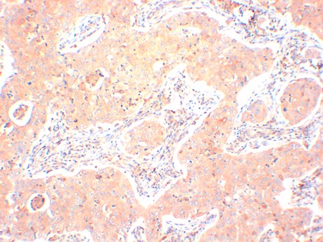 IkB Alpha Monoclonal Antibody (2A5)