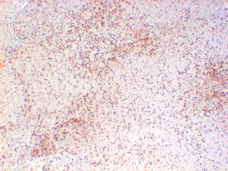 Myd88 Monoclonal Antibody (2H12)