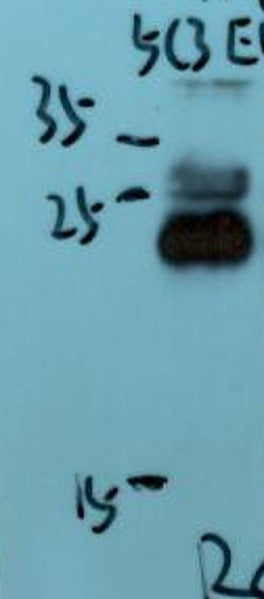 SOCS-1 Monoclonal Antibody (5C3)