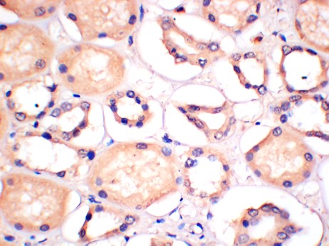 ERK5 Monoclonal Antibody (4G5)